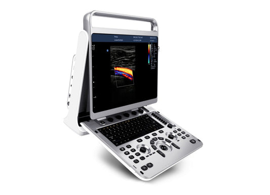 Chison Portable Digital Color Doppler Ultrasound System EBit 50: A Revolution in Portable Diagnostics