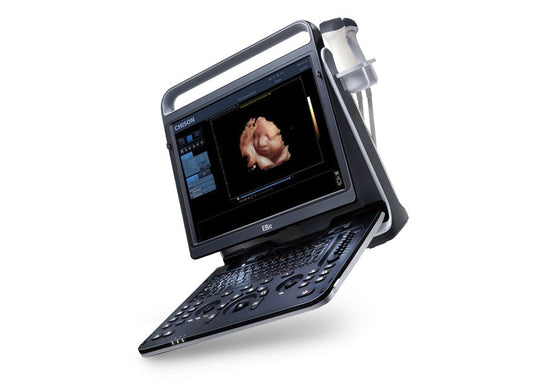 Market Prospects of the Portable Digital Color Doppler Ultrasound System EBit 60