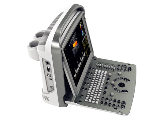 Portable Digital Color Doppler Ultrasound System ECO 6: Revolutionizing Medical Imaging