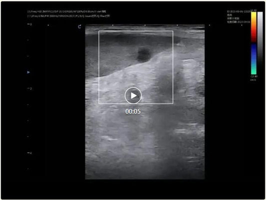 Suspected Splenic Tumor in Canine