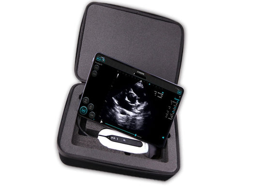 Discuss how the marketing strategy of handheld ultrasound machines should be adjusted in the context of technological progress