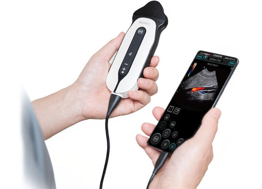 Chison Handheld Ultrasound Veterinary SonoEye P6 VET: A Game-Changer in Animal Healthcare