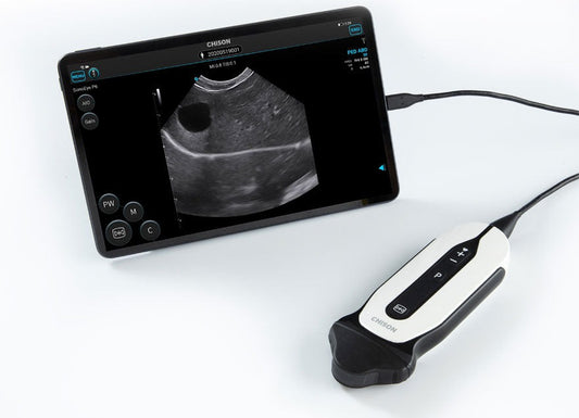 Explain how the wireless probe type of veterinary ultrasound machine is combined with telemedicine function