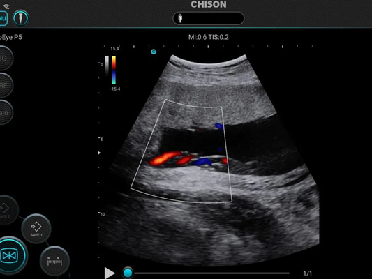 SonoEye in Obstetrics