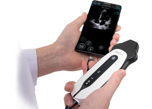 The Handheld Digital Doppler Ultrasound: Chison SonoEye P3