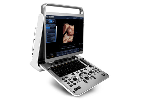 Portable Digital Color Doppler Ultrasound System EBit 30