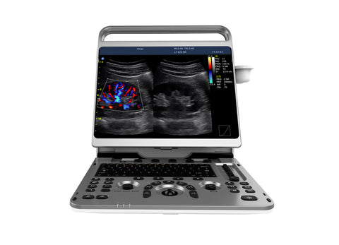 Portable Digital Color Doppler Ultrasound System EBit 50