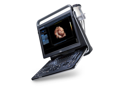 Portable Digital Color Doppler Ultrasound System EBit 60