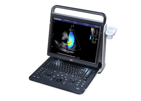 Portable Digital Color Doppler Ultrasound System EBit 60