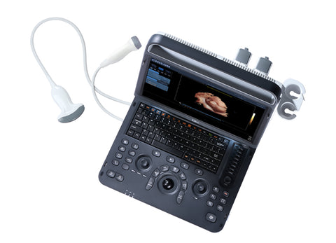 Portable Digital Color Doppler Ultrasound System EBit 60