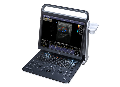 Portable Veterinary Color Doppler Ultrasound System EBit 60 VET