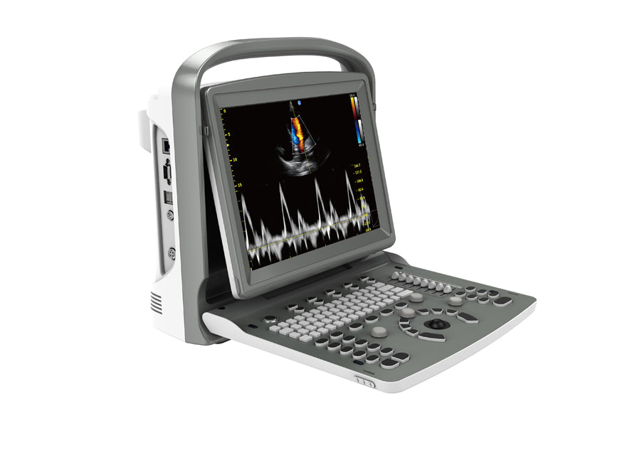 Portable Digital Color Doppler Ultrasound System ECO 6