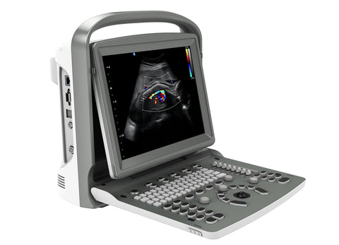 Portable Digital Color Doppler Ultrasound System ECO 6