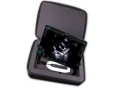 Handheld Digital Color Doppler Ultrasound System SonoEye P3