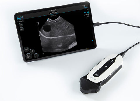 Handheld Digital Color Doppler Ultrasound System SonoEye P6