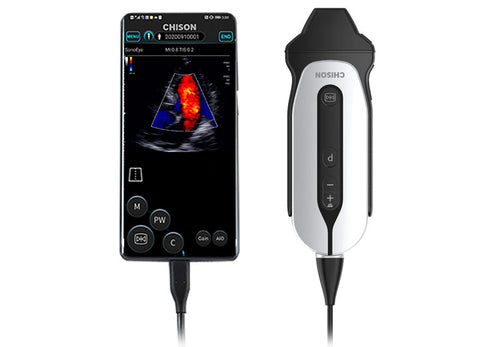 Handheld Digital Color Doppler Ultrasound System SonoEye P3